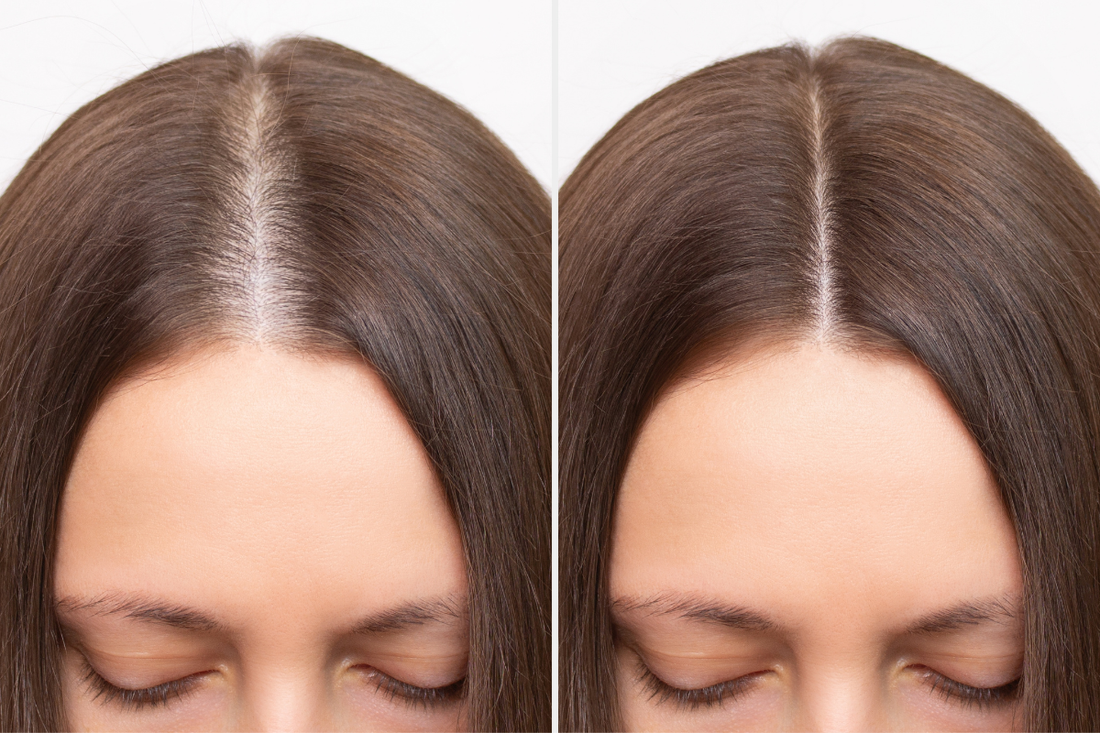 The 84-Day Protocol: Mapping the Clinical Shift from Shedding to Density.